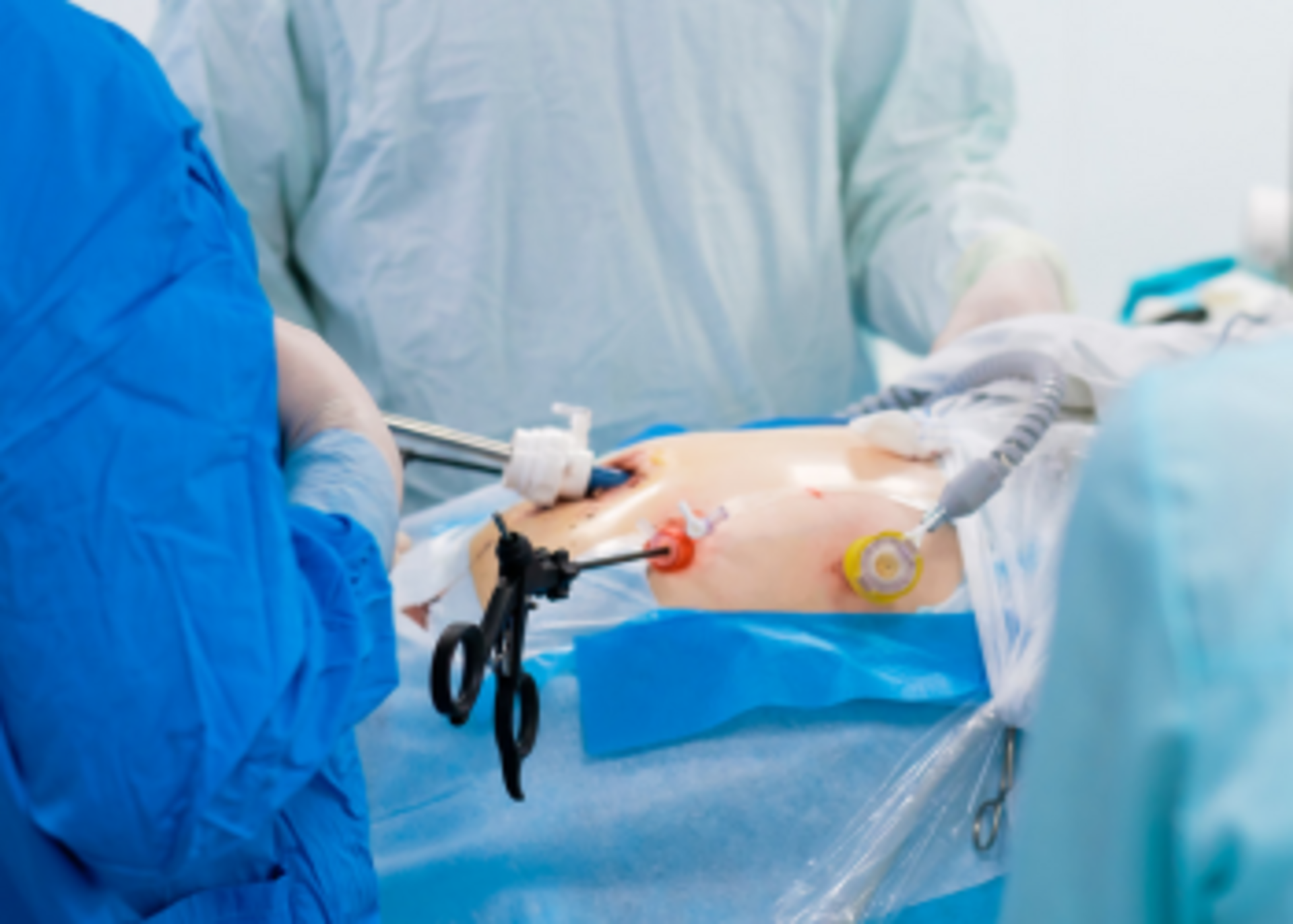 Minimally Invasive Spine Surgery (MISS)