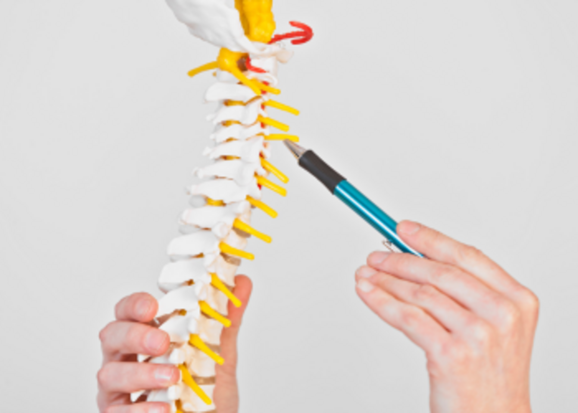 Cervical Laminectomy with instrumented fusion