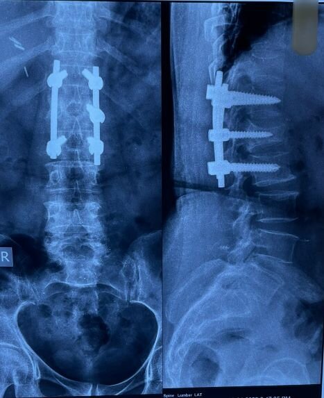 Dr. Sudheer Kumar Pothu|Sanath Nagar,Hyderabad